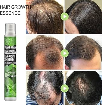 Où Acheter Du Finasteride