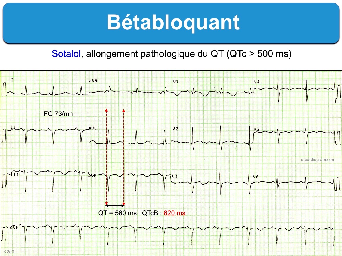 Comment acheter du propranolol
