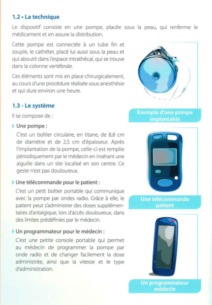 Pompe À Baclofène Prix