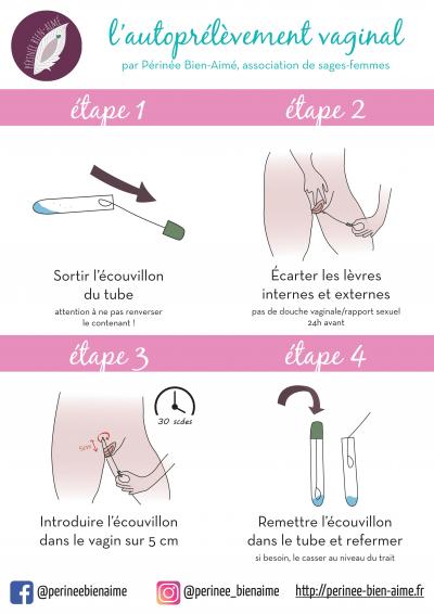 Fluconazole mycose sans ordonnance