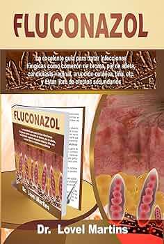 Diflucan 200 prix