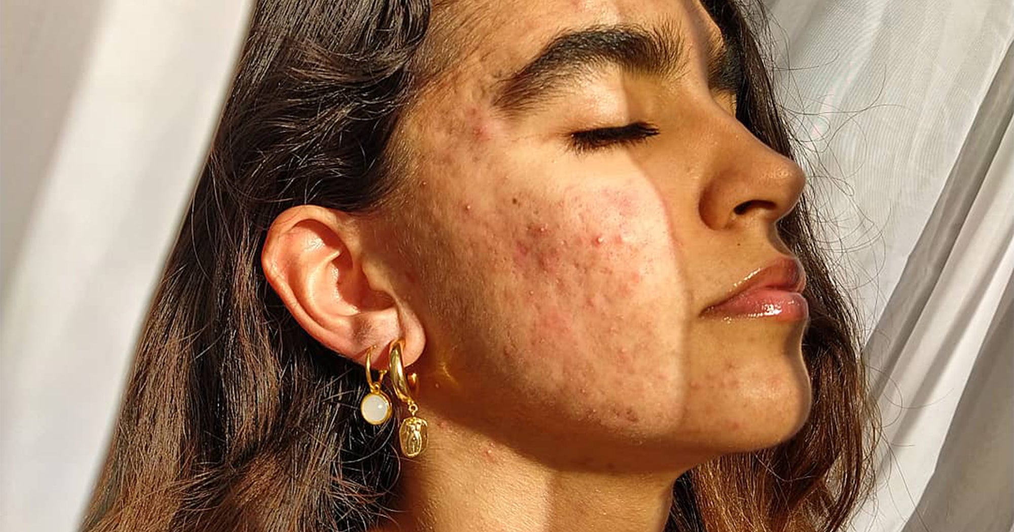 Roaccutane Pilules
