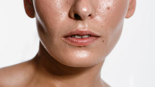Acheter Accutane En Ligne
