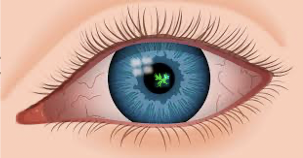 Zovirax ophtalmique sans ordonnance
