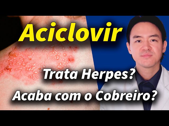 Aciclovir de 200mg ou 400mg