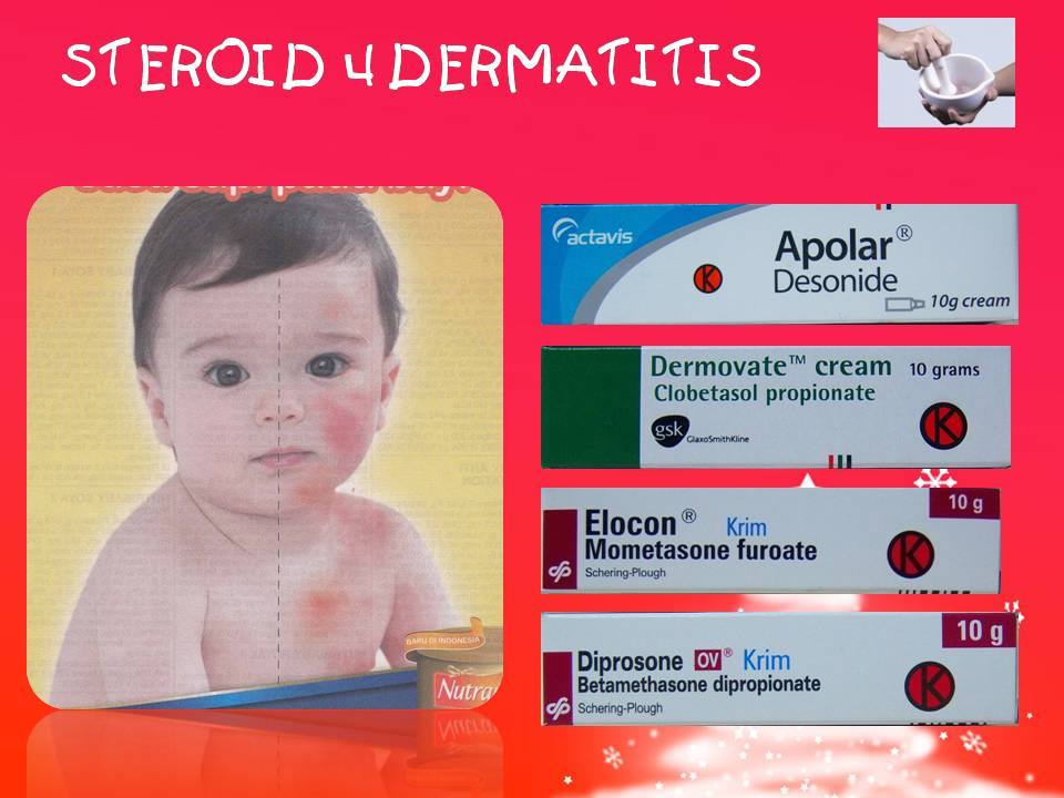 Diflucan 200 prix