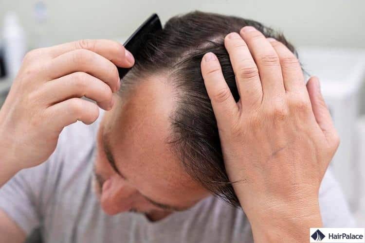 Finasteride Où Acheter