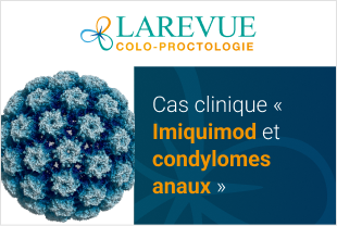 Limiquimod Prix