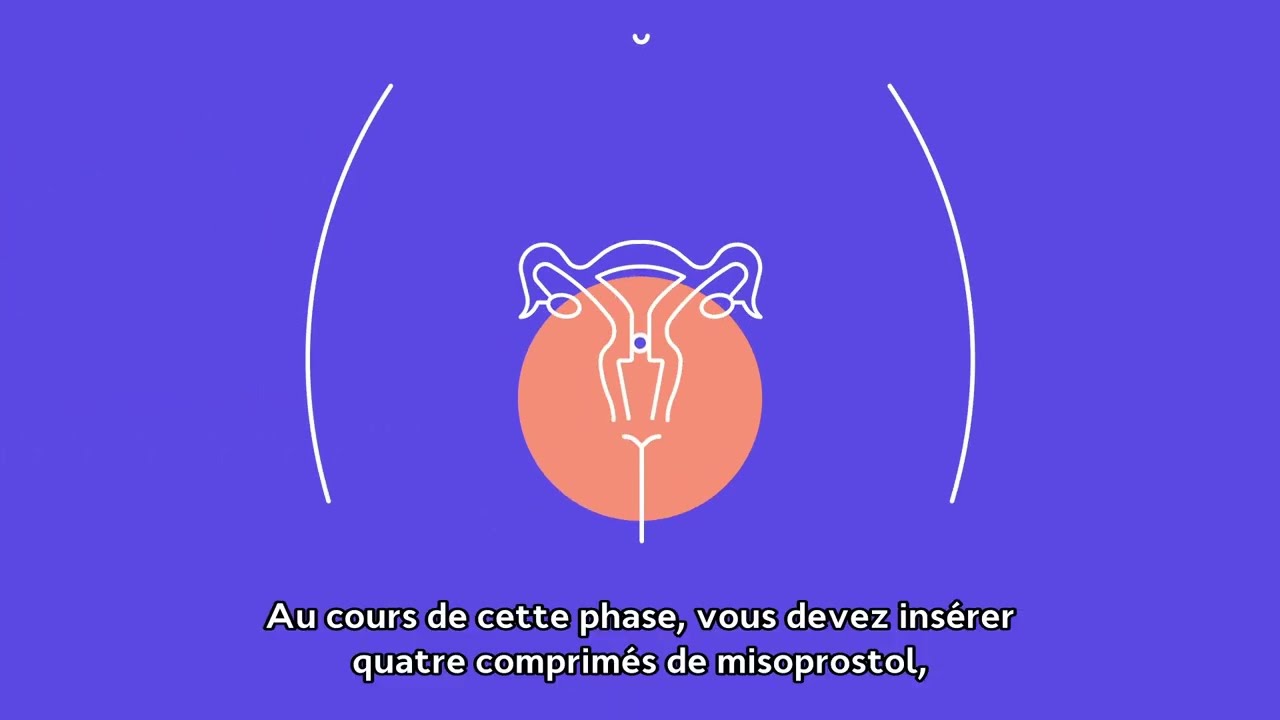 mectizan comment acheter