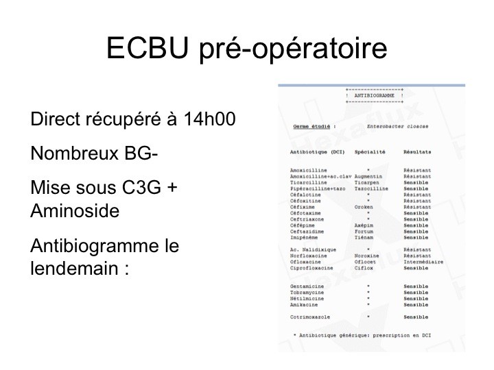 Acheter Du Ciprofloxacin Générique