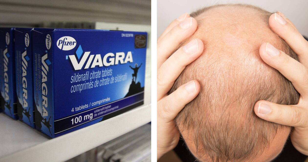 Acheter Du Finasteride
