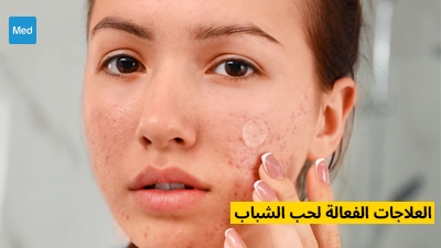 Zovirax Pommade Ophtalmique Prix