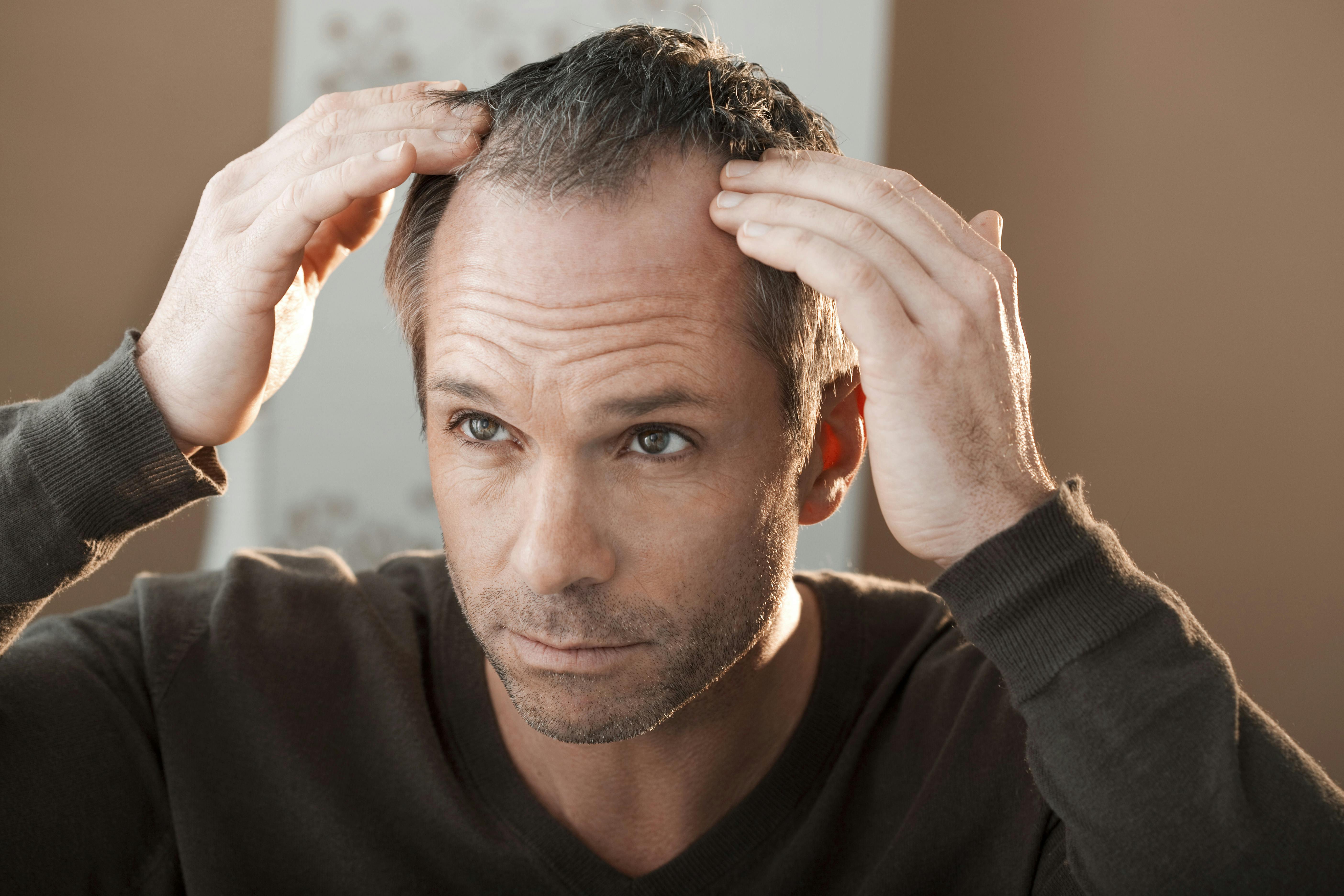 Prix Pour Finasteride