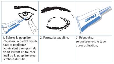 Prix de laciclovir
