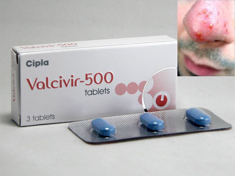 Valacyclovir 1000mg