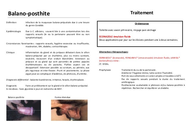 Fluconazole comprimé sans ordonnance