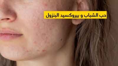 Prix Du Traitement Roaccutane