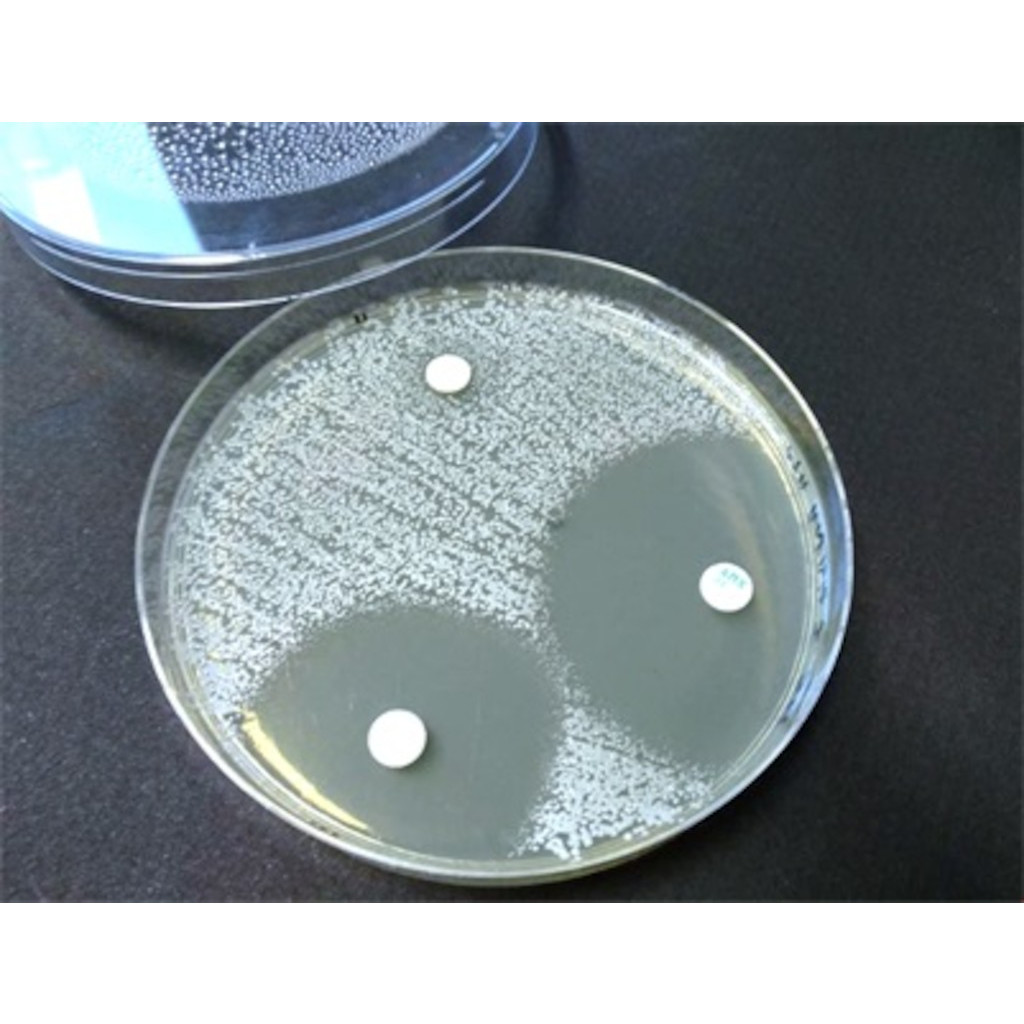 Ciprofloxacin Comment Acheter