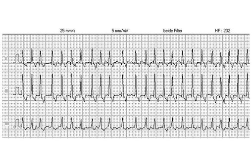 Acheter Propranolol En Ligne