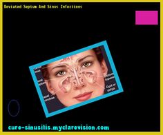 Azithromycin 250 Mg Cvs