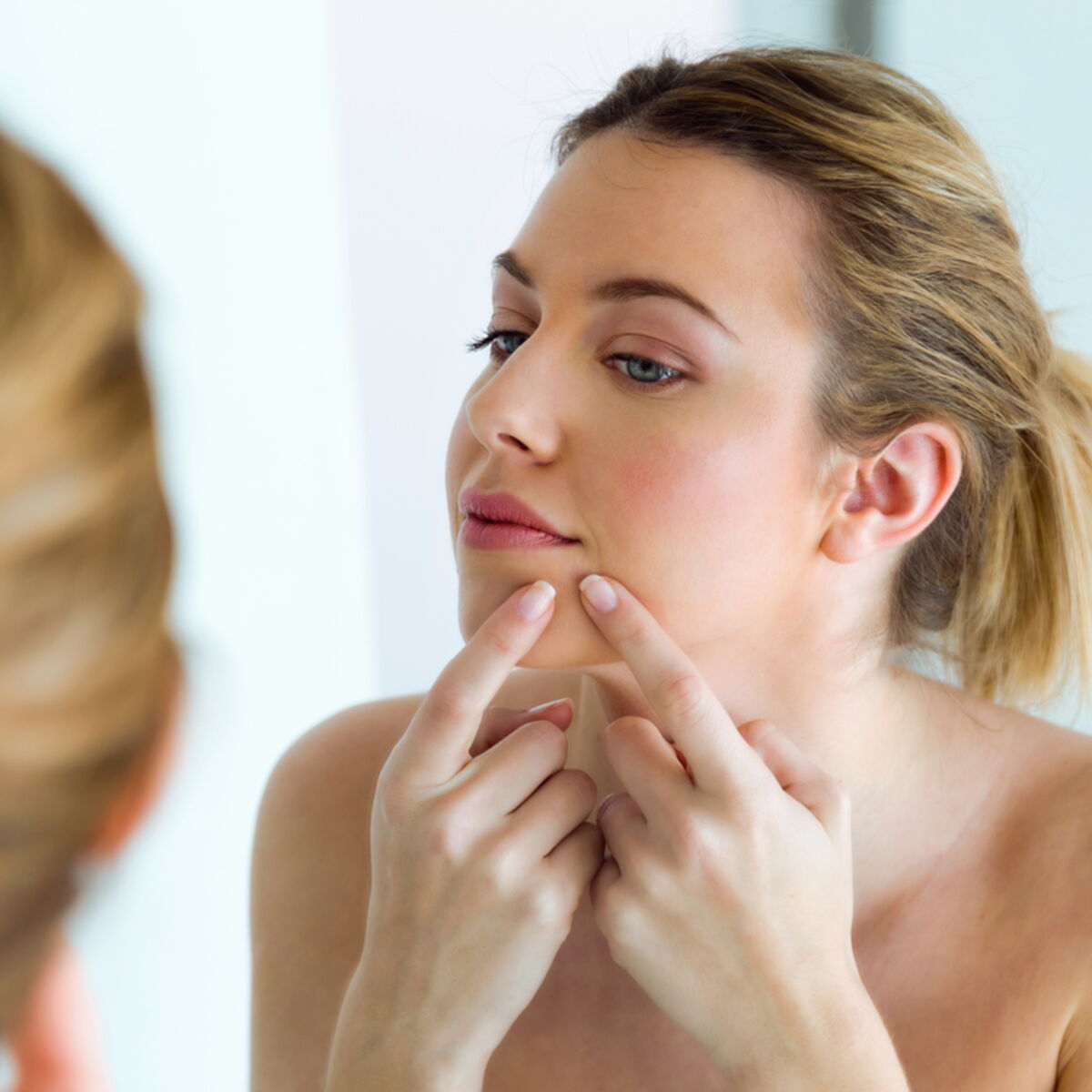 Roaccutane Arret Pilule