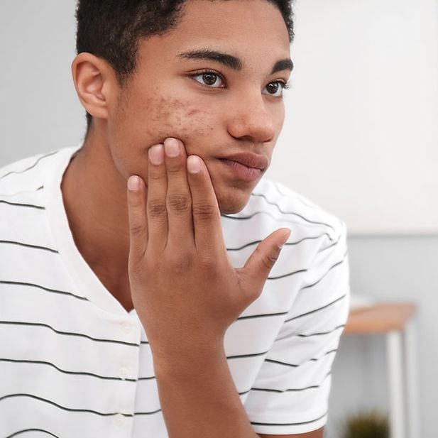 Commander Accutane Ligne