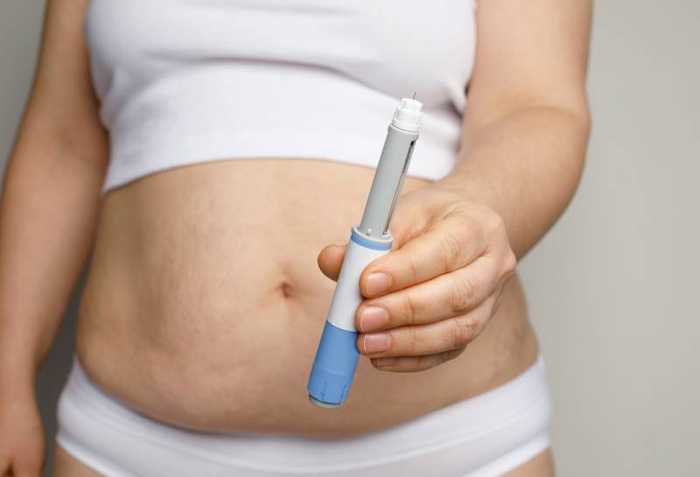 Prix Pour Phentermine