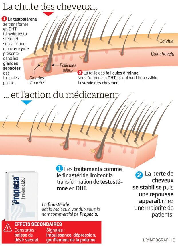 Finasteride Pilule