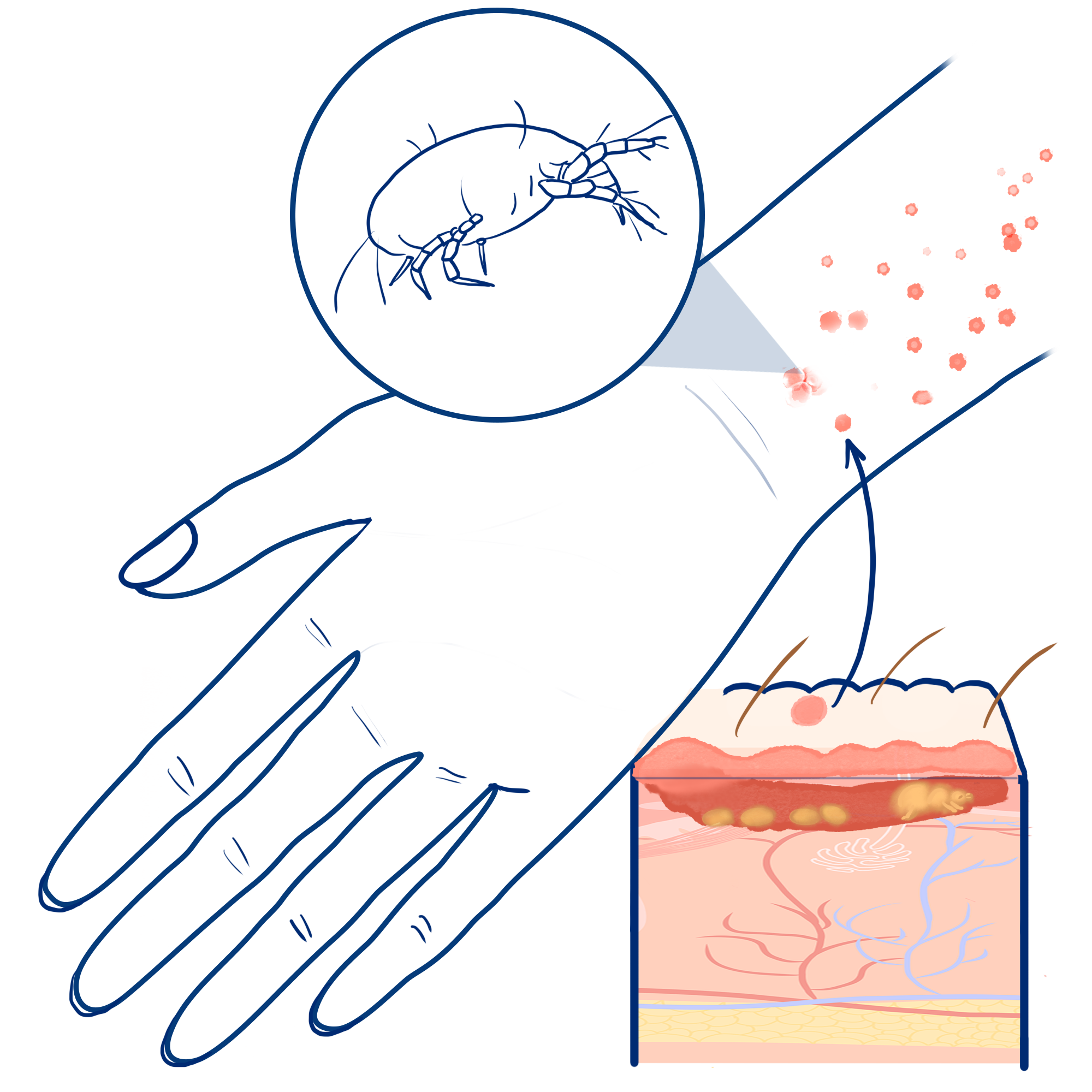 Ermetin Ivermectin 3mg