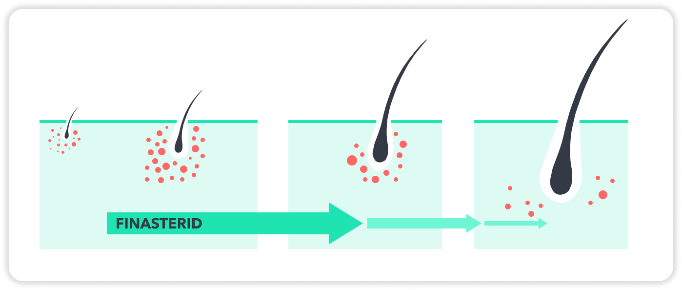Finasteride Don Du Sang