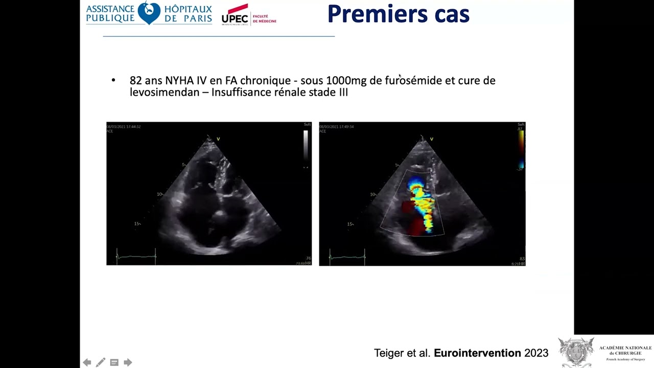 Furosemide Achat En Ligne