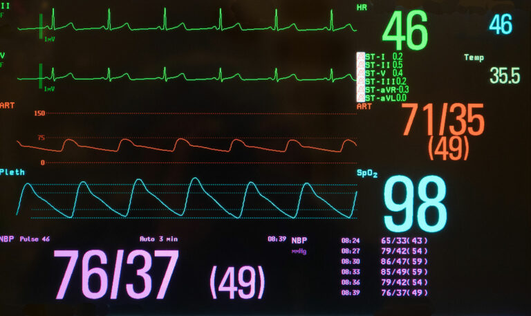 Inderal La Cap 80 Mg