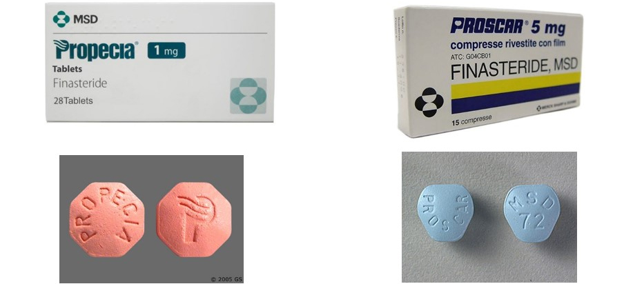 Prix Finasteride 5mg