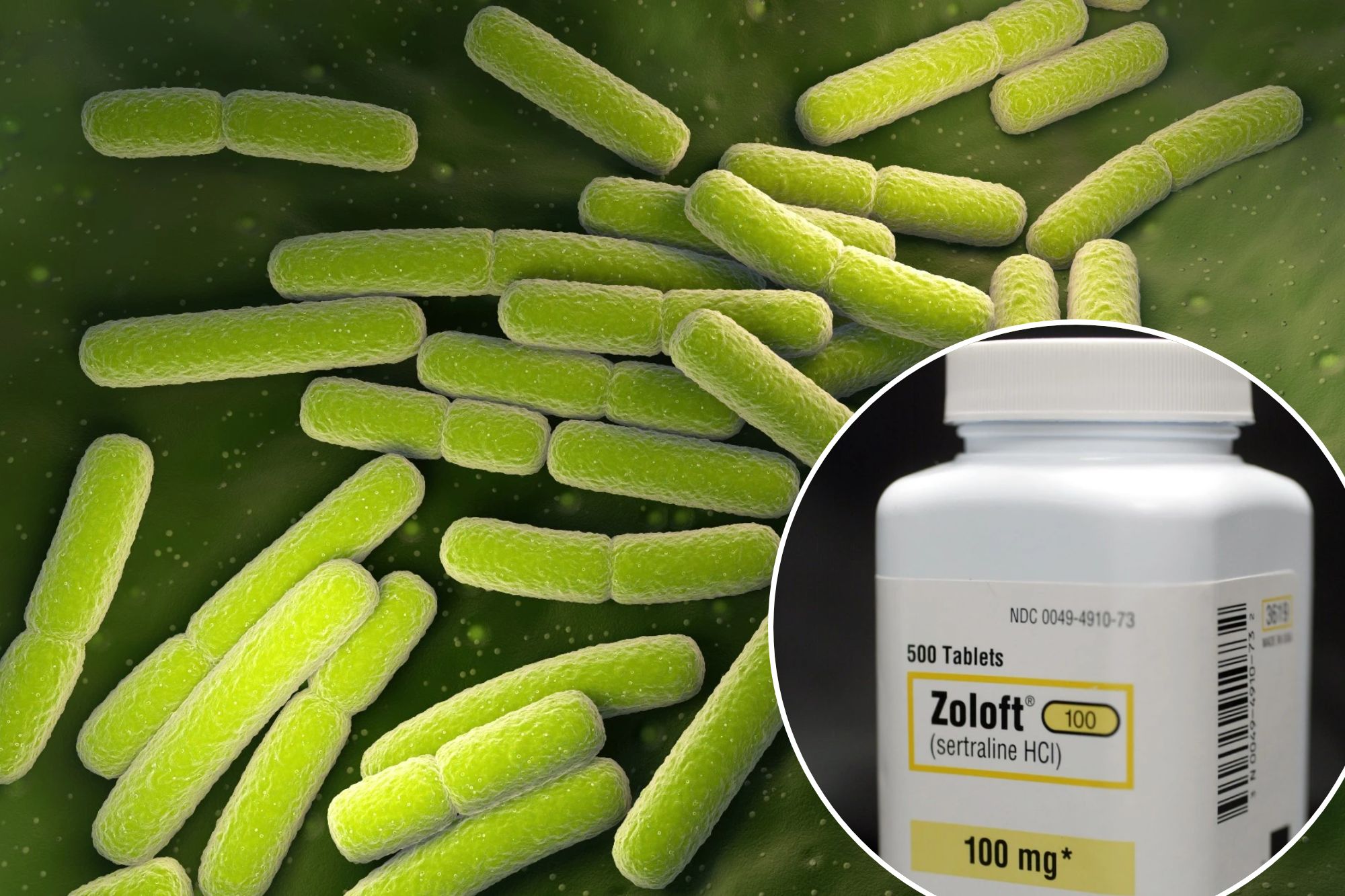 Zoloft hcl 100mg
