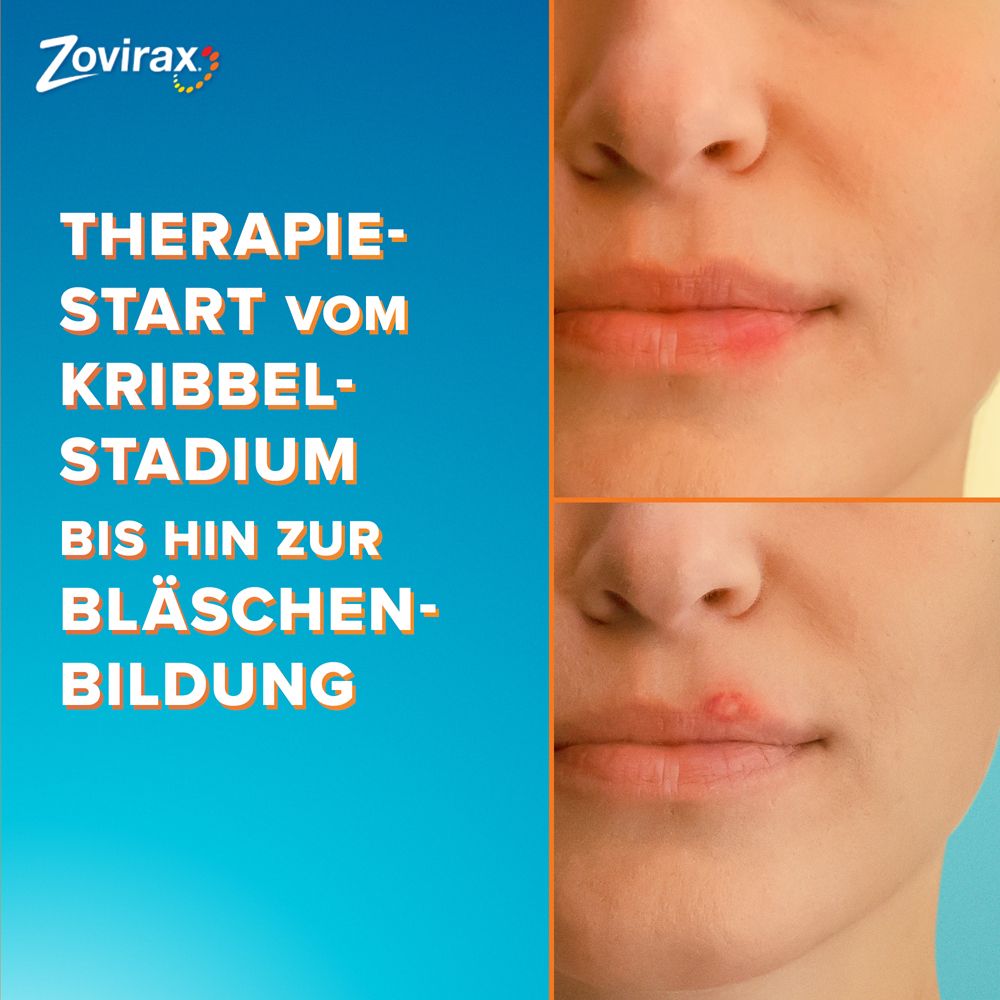 Zovirax 5 Prix